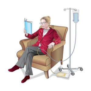 Patient-Receiving-Peritoneal-Dialysis A medical illustration that shows a patient receiving peritoneal dialysis