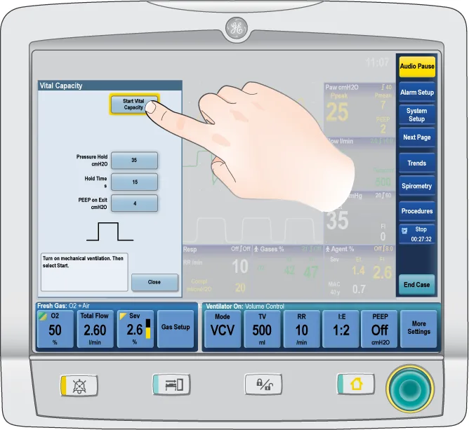 Technical illustration of an anesthesia machine touchscreen showing navigation controls and operator interaction during equipment training.
