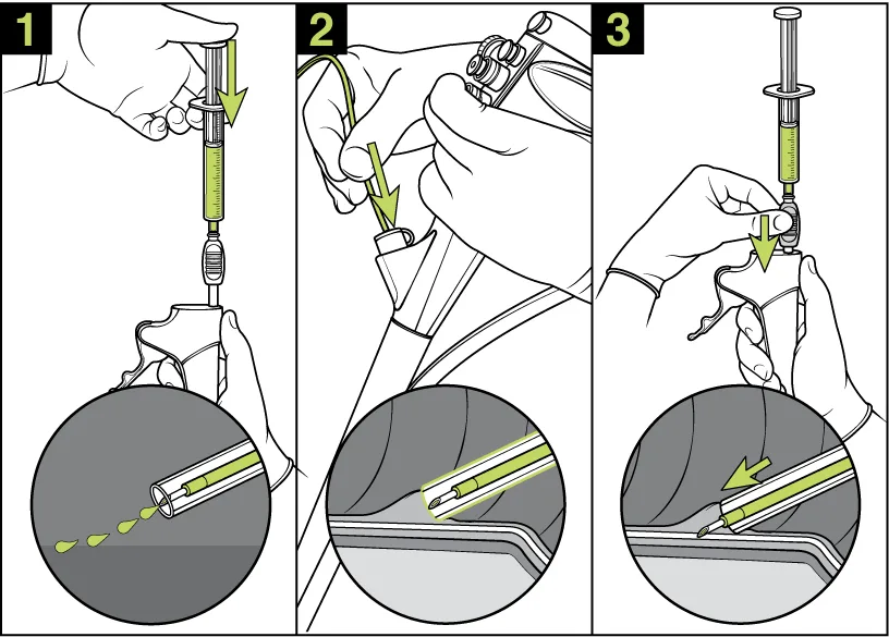 Wordless step-by-step technical illustration showing a medical device setup procedure with detailed visual instructions and callouts.